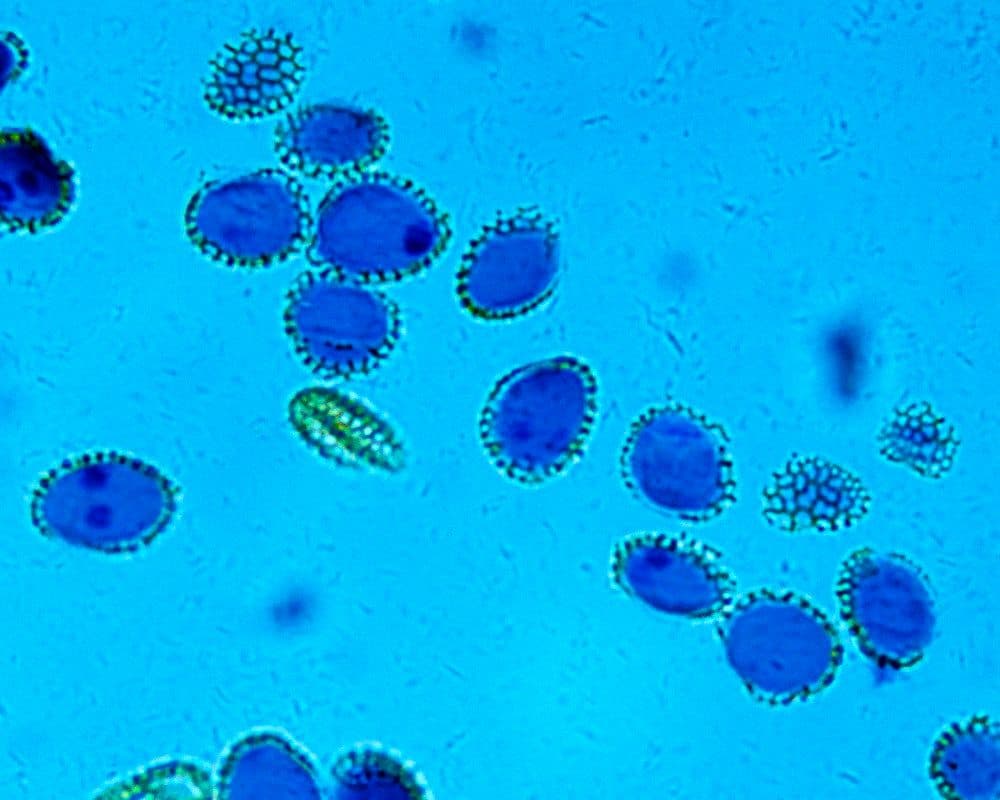 Microorganismos En La Producción de Energia Biogas.jpg